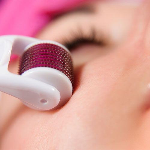 Derma roller